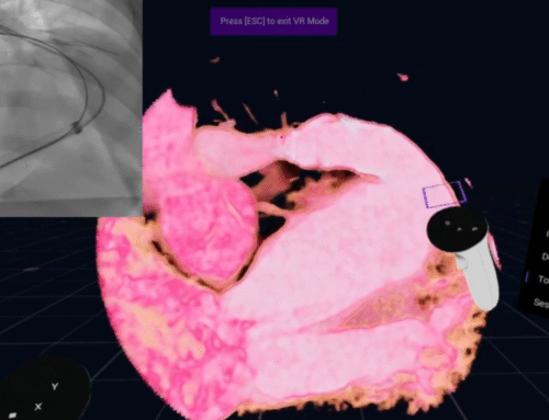 PA, VSD (Pulmonary Atresia, Ventricular Septal Defect) live commentary by Dr. Ali Houeijeh